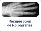Recuperación de Radiografías